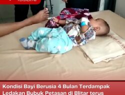 Kondisi Bayi Berusia 4 Bulan Terdampak Ledakan Bubuk Petasan di Blitar terus Membaik