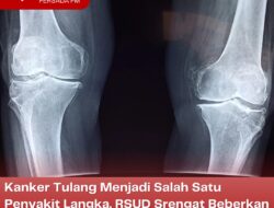 Kanker Tulang Menjadi Salah Satu Penyakit Langka, RSUD Srengat Beberkan Sejumlah Gejalanya